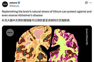 Nature：锂可逆转老年痴呆
