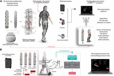 让瘫痪患者重新行走！脊髓电刺激+康复机器人｜Science子刊