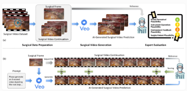 研究发现谷歌 AI 模型 Veo-3 可生逼真成手术视频但缺乏医学逻辑理解