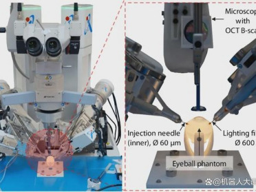Science Robotics｜中国团队新突破：眼科自主手术机器人，注射成功率100%！